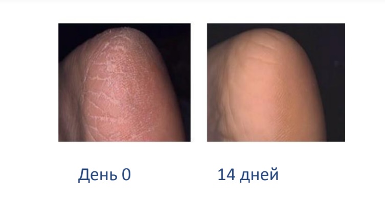 педикюр в домашних условиях