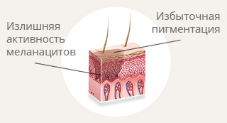 (11)-Баннер-с-кожей.jpg